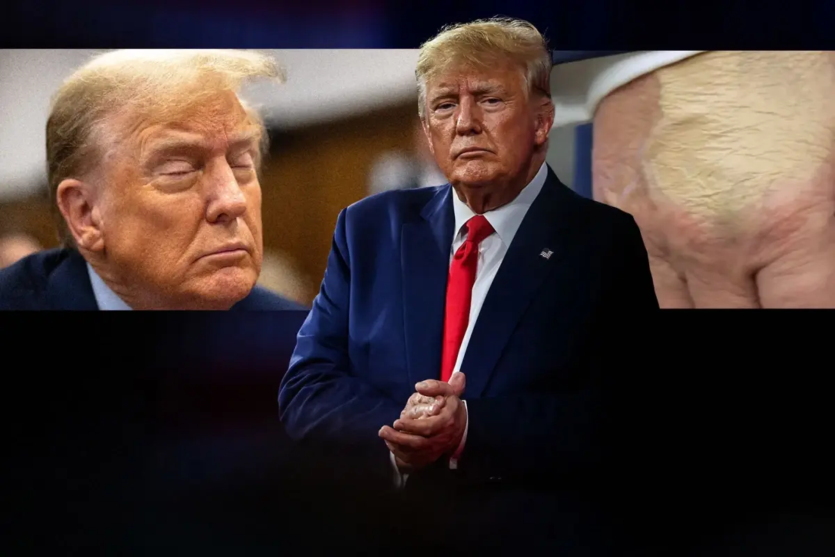 **Trump’ın Sağlık Sorunları Gündemi Sarsıyor**