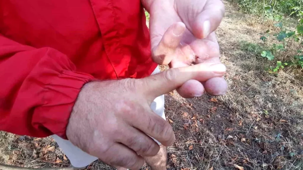 Ayı Saldırısında Trajedi: Bir Kişi Parmağını Kaybetti