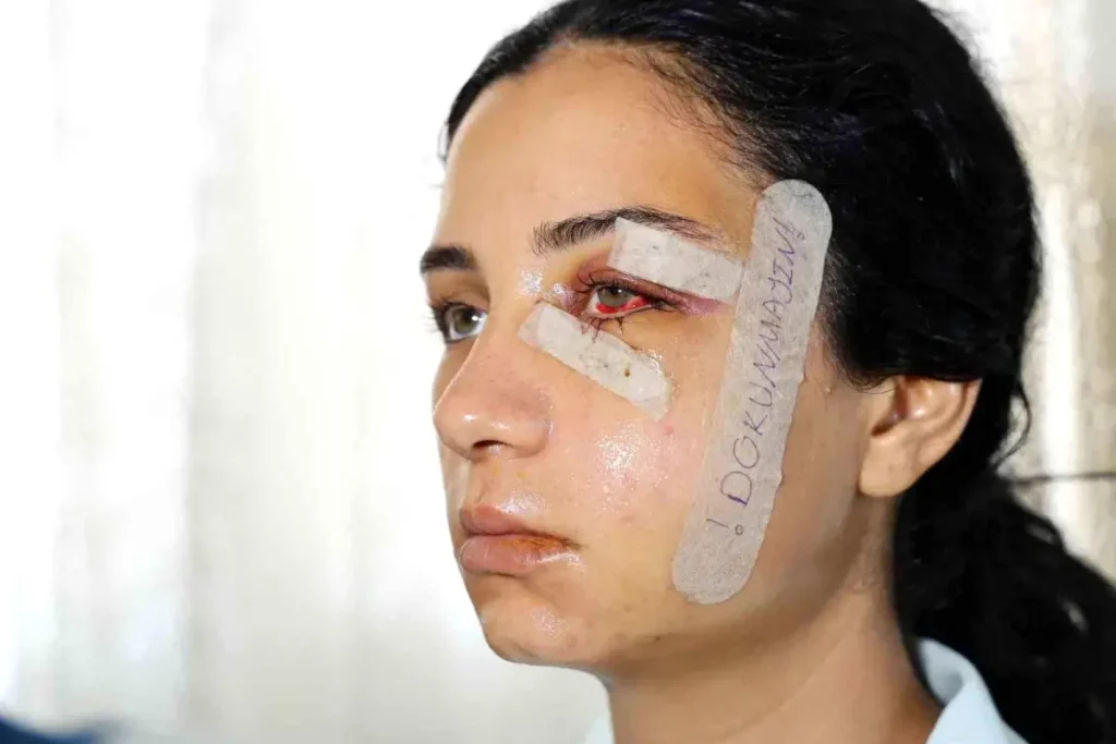 Şiddete Uğrayan Kadın, Eski Eşinin Cezasını Kefil Oldu