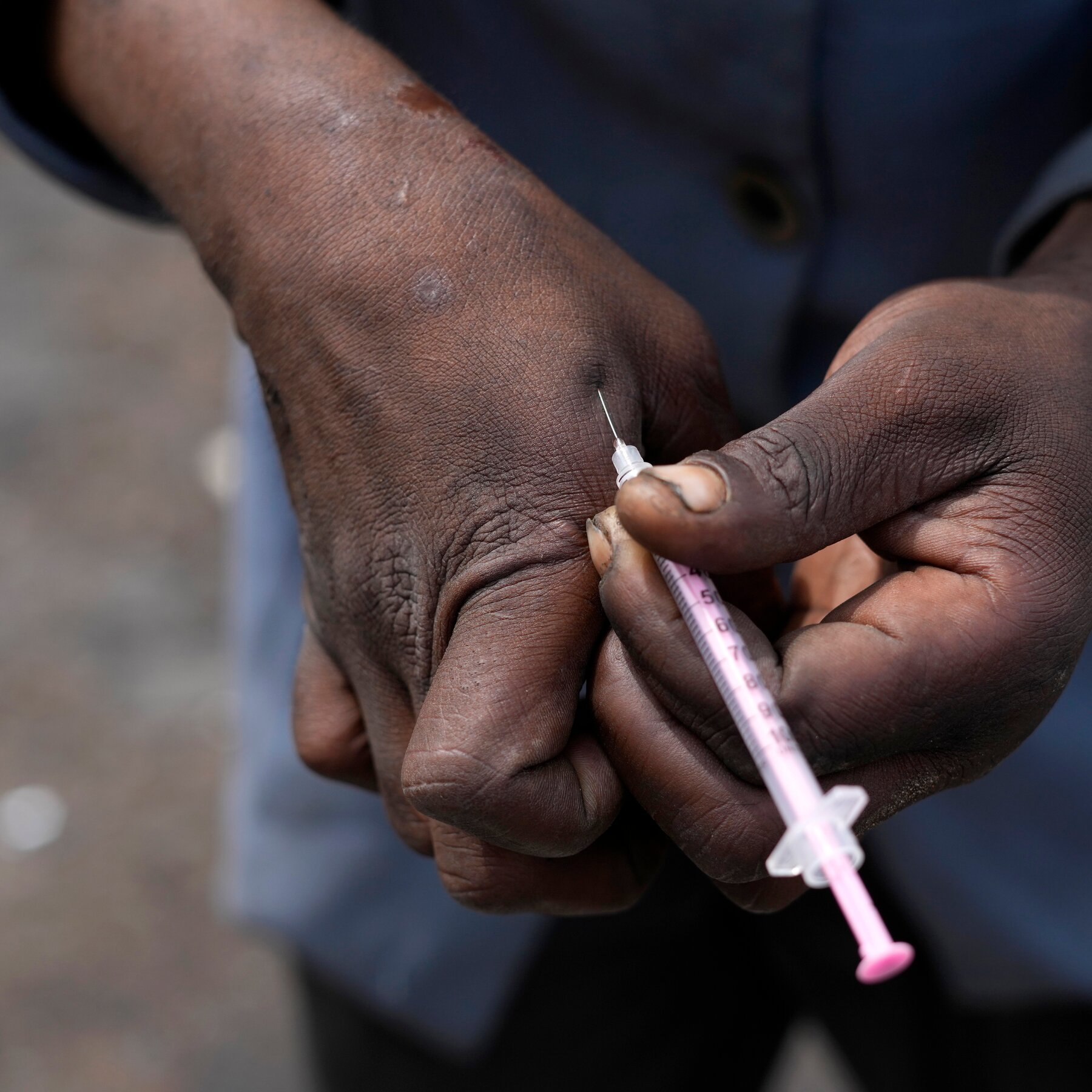 Blood-Sharing ‘Bluetoothing’ Trend Sparks Alarming Global HIV Surge