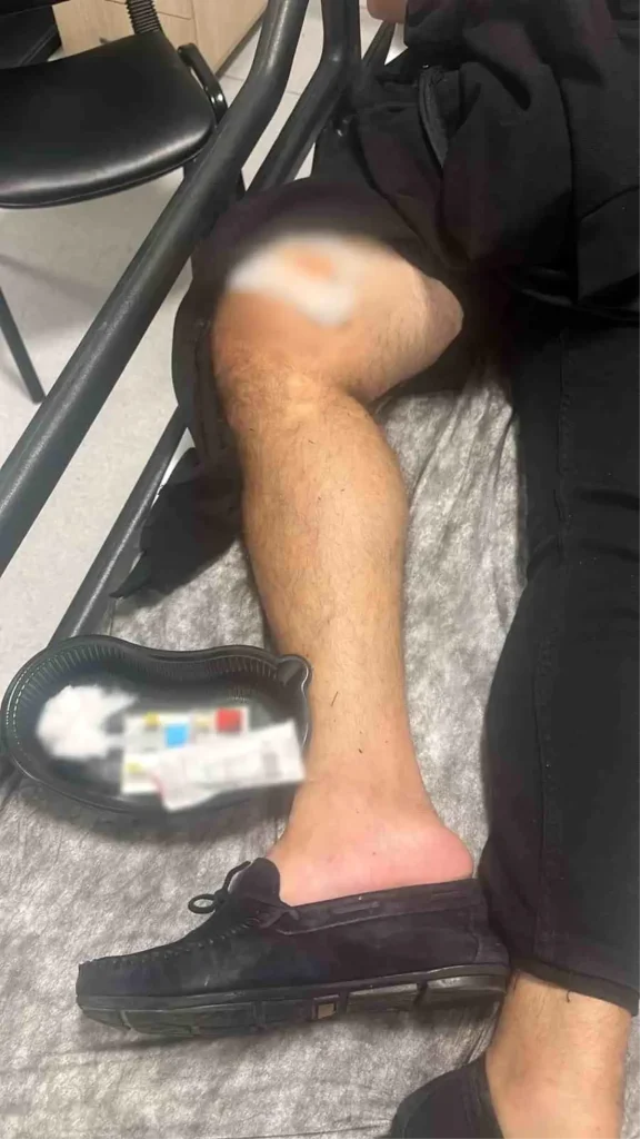 Marmaris’te Alacak Verecek Tartışması Silahlı Kavgaya Dönüştü