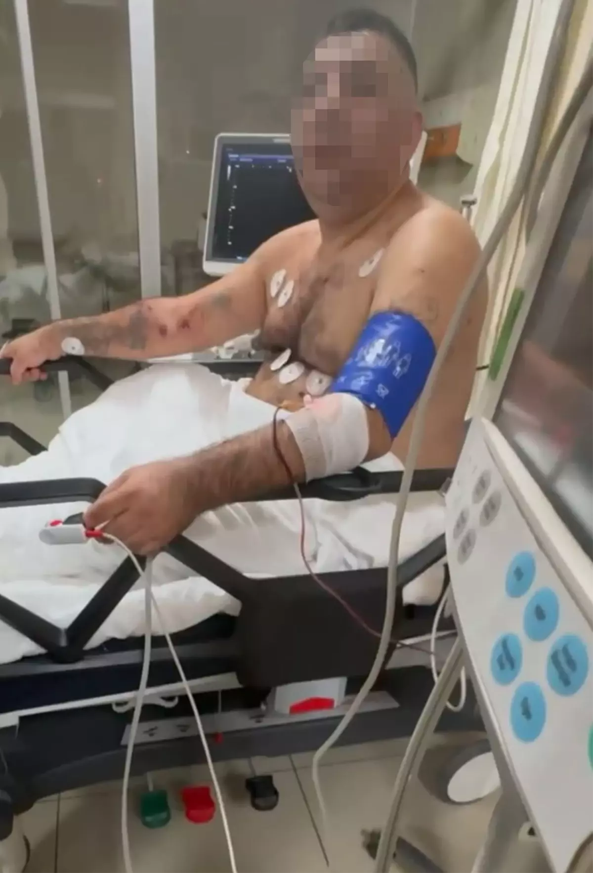 Bayrampaşa’da Pompalı Tüfekle Rastgele Ateş Açan Şahıs Gözaltında: 1 Polis ve 4 Sivilli Yaralı