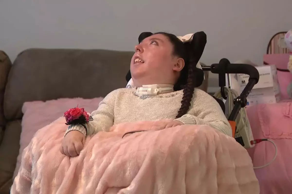 Beyinsiz Doğan Alex 20 Yaşında, Doktorlar 5 Yıl Yaşamaz Dedi