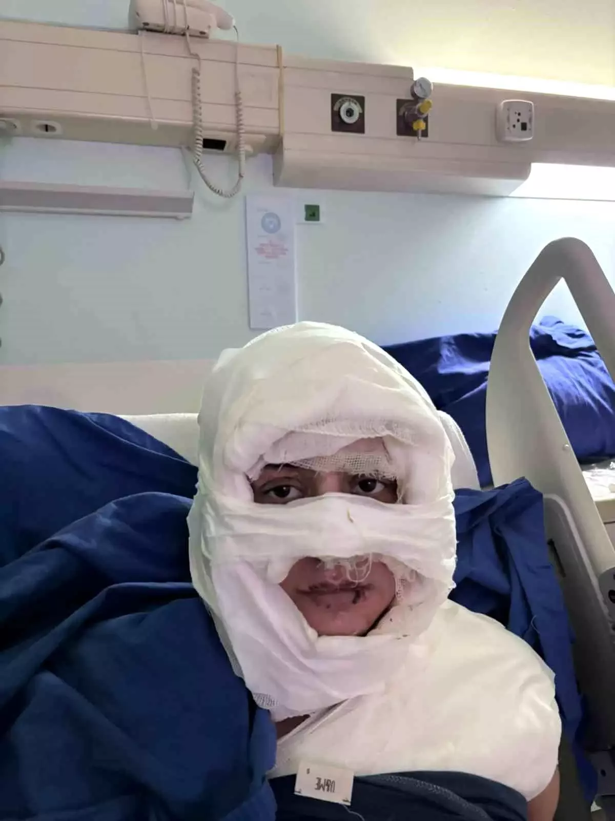 Kadıköy’de Kadına Yanıcı Madde Saldırısı: Ağır Yanıklar ve Tutuklama