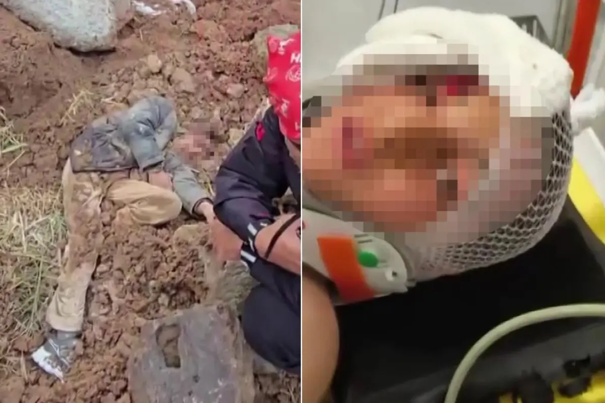 Dayısının Diri Diri Toprağa Gömdüğü Çocuğun İlk İsteği Yürek Burktu