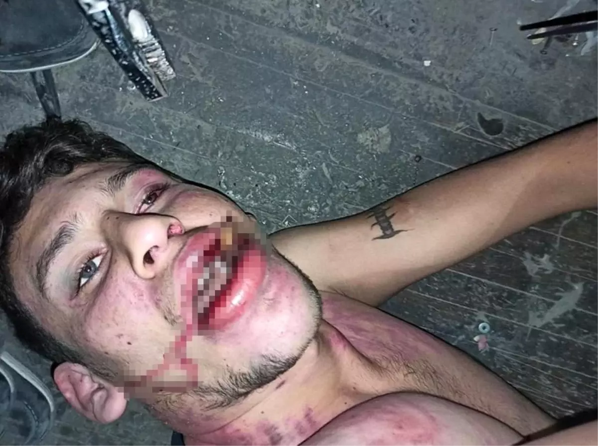 Antalya’da Şok İşkence Davası: 4 Sanığa Toplam 27 Yıl Hapis Cezası