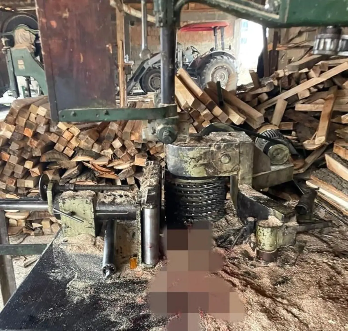 Boyabat’ta İş Kazası: İşçi Hızar Makinesine Kolunu Kaptırdı