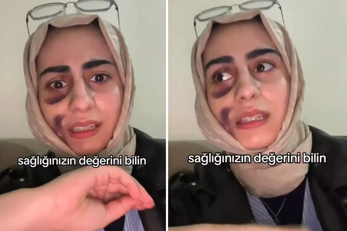 Stajyer Diş Hekimi Tedavi Sonrası Kadının Ağrısı ve Sosyal Medya İsyanı Gündemi Salladı